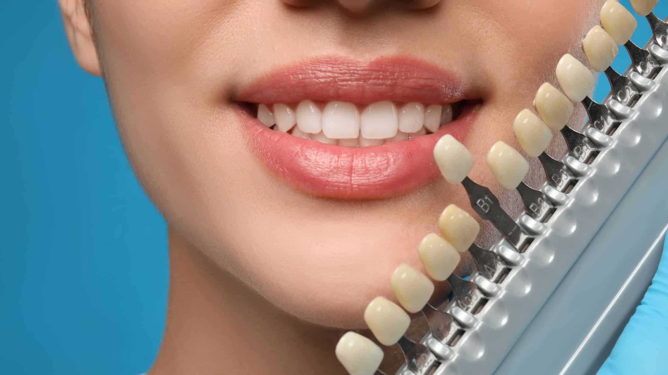 Stained Or Discolored Teeth? Why Cosmetic Dentistry Offers The Best Fix