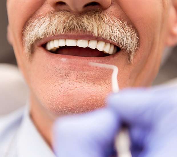 Greenacres Adjusting to New Dentures