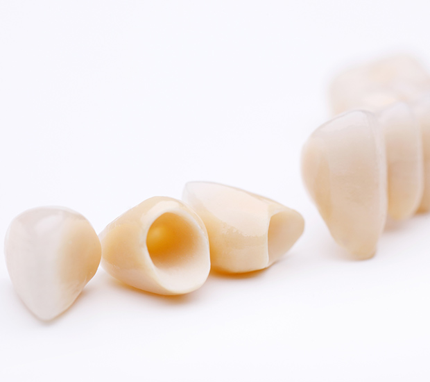 Greenacres Dental Crowns and Dental Bridges