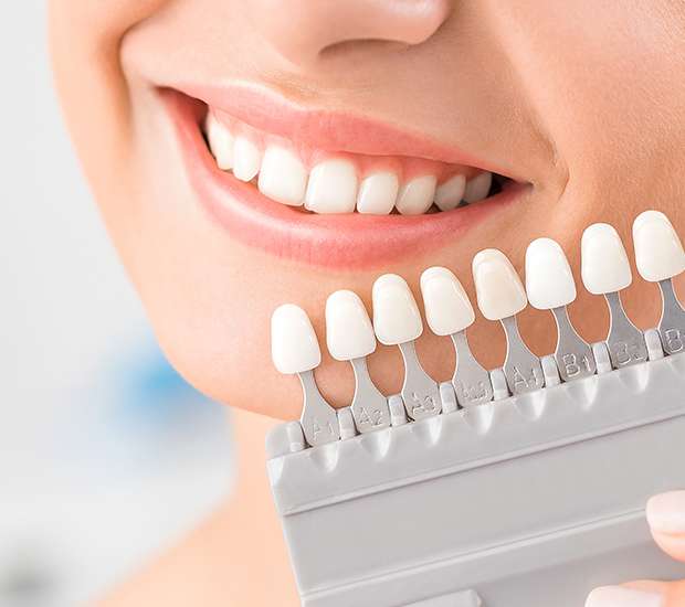 Greenacres Dental Veneers and Dental Laminates