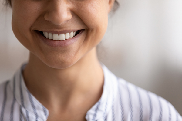 Ask A General Dentist &# ; When Is A Crown, A Bridge, Or A Dental Implant Recommended?