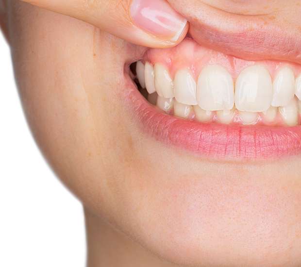 Greenacres Gum Disease
