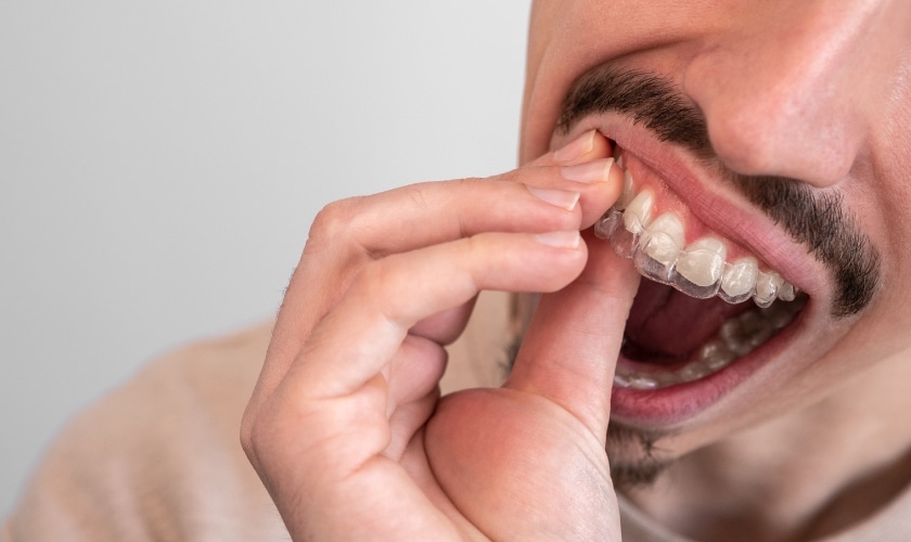 A Complete Guide To Soothing Invisalign Gum Discomfort