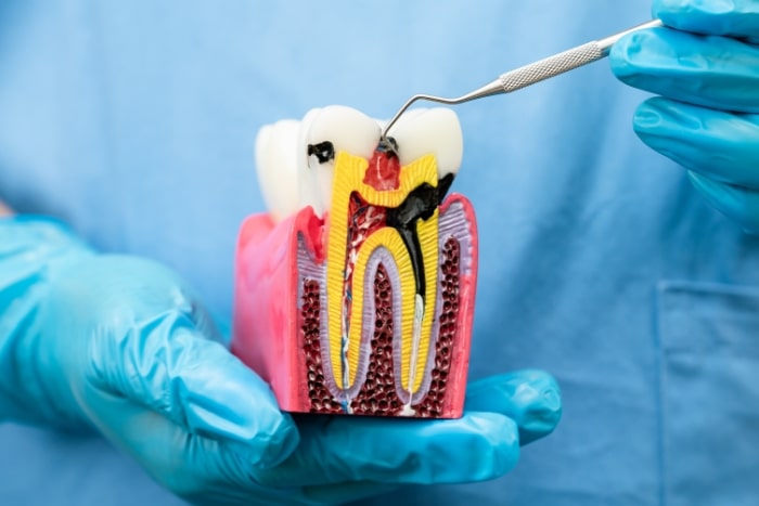 Prevent Tooth Pain In The New Year: How Root Canal Treatment Can Save You From Future Dental Emergencies